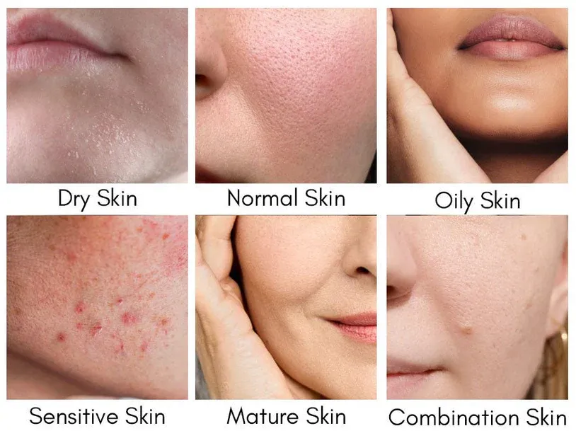 Signs and characteristics of facial skin types